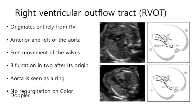 Fetal echocardiography