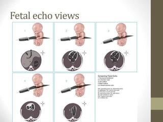 Fetal echo views
 