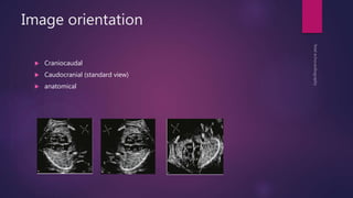 Image orientation
 Craniocaudal
 Caudocranial (standard view)
 anatomical
 