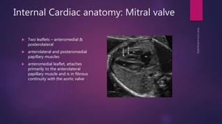 Internal Cardiac anatomy: Mitral valve
 Two leaflets – anteromedial &
posterolateral
 anterolateral and posteromedial
papillary muscles
 anteromedial leaflet, attaches
primarily to the anterolateral
papillary muscle and is in fibrous
continuity with the aortic valve
 