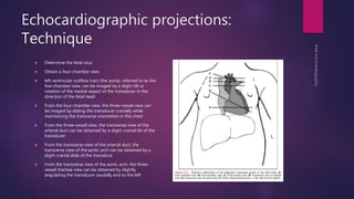 Echocardiographic projections:
Technique
 Determine the fetal situs
 Obtain a four-chamber view
 left ventricular outflow tract (the aorta), referred to as the
five-chamber view, can be imaged by a slight tilt or
rotation of the medial aspect of the transducer in the
direction of the fetal head
 From the four-chamber view, the three-vessel view can
be imaged by sliding the transducer cranially while
maintaining the transverse orientation in the chest
 From the three-vessel view, the transverse view of the
arterial duct can be obtained by a slight cranial tilt of the
transducer
 From the transverse view of the arterial duct, the
transverse view of the aortic arch can be obtained by a
slight cranial slide of the transduce
 From the transverse view of the aortic arch, the three-
vessel-trachea view can be obtained by slightly
angulating the transducer caudally and to the left
 