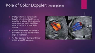 Role of Color Doppler: Image planes
 The four-chamber plane in color
Doppler is best visualized from an
apical (A) or a basal (B) view in order
to demonstrate ventricular filling
either in red (A) or in blue (B) in
diastole.
 In these orientations, the course of
blood flow is nearly parallel to the
angle of insonation.
 No flow is present during ventricular
systole unless TR is present.
 