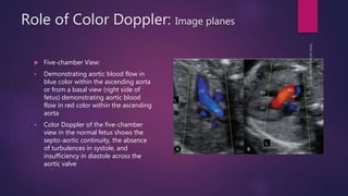 Role of Color Doppler: Image planes
 Five-chamber View:
 Demonstrating aortic blood flow in
blue color within the ascending aorta
or from a basal view (right side of
fetus) demonstrating aortic blood
flow in red color within the ascending
aorta
 Color Doppler of the five-chamber
view in the normal fetus shows the
septo-aortic continuity, the absence
of turbulences in systole, and
insufficiency in diastole across the
aortic valve
 
