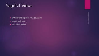 Sagittal Views
 Inferior and superior vena cava view
 Aortic arch view
 Ductal arch view
 