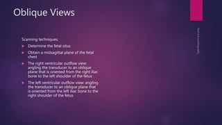 Oblique Views
Scanning techniques:
 Determine the fetal situs
 Obtain a midsagittal plane of the fetal
chest
 The right ventricular outflow view:
angling the transducer to an oblique
plane that is oriented from the right iliac
bone to the left shoulder of the fetus
 The left ventricular outflow view: angling
the transducer to an oblique plane that
is oriented from the left iliac bone to the
right shoulder of the fetus
 