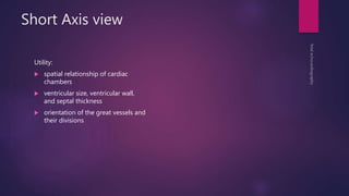 Short Axis view
Utility:
 spatial relationship of cardiac
chambers
 ventricular size, ventricular wall,
and septal thickness
 orientation of the great vessels and
their divisions
 