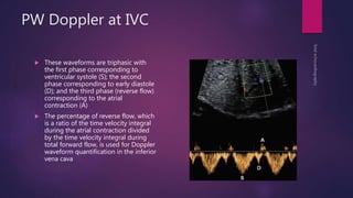 PW Doppler at IVC
 These waveforms are triphasic with
the first phase corresponding to
ventricular systole (S); the second
phase corresponding to early diastole
(D); and the third phase (reverse flow)
corresponding to the atrial
contraction (A)
 The percentage of reverse flow, which
is a ratio of the time velocity integral
during the atrial contraction divided
by the time velocity integral during
total forward flow, is used for Doppler
waveform quantification in the inferior
vena cava
 