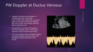 PW Doppler at Ductus Venosus
 Doppler waveforms are biphasic in
morphology with a first peak
concomitant with systole (S); a second
peak concomitant with early diastole
(D); and a nadir concomitant with the
atrial contraction (A)
 forward flow is present throughout
the entire cardiac cycle in the ductus
venosus in the normal human fetus
 Two such indices were developed based
on peak velocities during systole and
during the atrial contraction (S/A,
S-A/S)
 