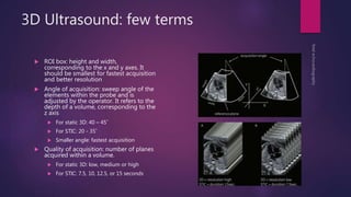 3D Ultrasound: few terms
 ROI box: height and width,
corresponding to the x and y axes. It
should be smallest for fastest acquisition
and better resolution
 Angle of acquisition: sweep angle of the
elements within the probe and is
adjusted by the operator. It refers to the
depth of a volume, corresponding to the
z axis
 For static 3D: 40 – 45˚
 For STIC: 20 - 35˚
 Smaller angle: fastest acquisition
 Quality of acquisition: number of planes
acquired within a volume.
 For static 3D: low, medium or high
 For STIC: 7.5, 10, 12.5, or 15 seconds
 