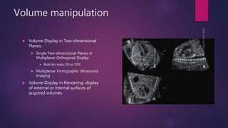 Volume manipulation
 Volume Display in Two-dimensional
Planes:
 Single Two-dimensional Planes or
Multiplanar Orthogonal Display
 Both for static 3D or STIC
 Multiplanar Tomographic Ultrasound
Imaging
 Volume Display in Rendering: display
of external or internal surfaces of
acquired volumes
 