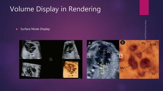 Volume Display in Rendering
 Surface Mode Display
 