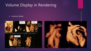 Volume Display in Rendering
 Inversion Mode:
 