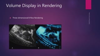 Volume Display in Rendering
 Three-dimensional B-flow Rendering
 