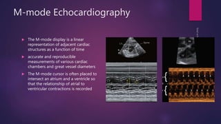 M-mode Echocardiography
 The M-mode display is a linear
representation of adjacent cardiac
structures as a function of time
 accurate and reproducible
measurements of various cardiac
chambers and great vessel diameters
 The M-mode cursor is often placed to
intersect an atrium and a ventricle so
that the relationship of atrial to
ventricular contractions is recorded
 