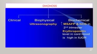 DIAGNOSIS
27
 
