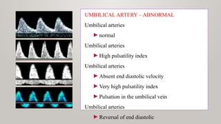 UMBILICAL ARTERY – ABNORMAL
Umbilical arteries
►normal
Umbilical arteries
►High pulsatility index
Umbilical arteries
►Absent end diastolic velocity
►Very high pulsatility index
►Pulsation in the umbilical vein
Umbilical arteries
►Reversal of end diastolic
 