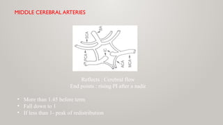 Reflects : Cerebral flow
End points : rising PI after a nadir
• More than 1.45 before term
• Fall down to 1
• If less than 1- peak of redistribution
MIDDLE CEREBRAL ARTERIES
 