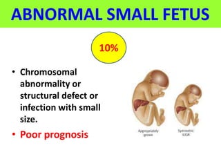 ABNORMAL SMALL FETUS
• Chromosomal
abnormality or
structural defect or
infection with small
size.
• Poor prognosis
10%
 