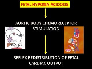 FETAL HYPOXIA-ACIDOSIS
FETAL HYPOXIA-ACIDOSIS
 