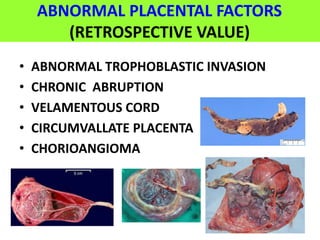 ABNORMAL PLACENTAL FACTORS
(RETROSPECTIVE VALUE)
• ABNORMAL TROPHOBLASTIC INVASION
• CHRONIC ABRUPTION
• VELAMENTOUS CORD
• CIRCUMVALLATE PLACENTA
• CHORIOANGIOMA
 