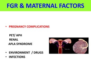 FGR & MATERNAL FACTORS
• PREGNANCY COMPLICATIONS
PET/ APH
RENAL
APLA SYNDROME
• ENVIRONMENT / DRUGS
• INFECTIONS
PIH /HDP
 