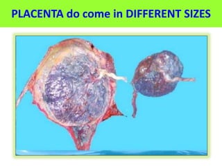 PLACENTA do come in DIFFERENT SIZES
 