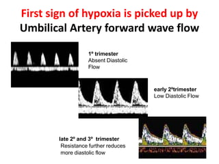 First sign of hypoxia is picked up by
Umbilical Artery forward wave flow
1º trimester
Absent Diastolic
Flow
early 2ºtrimester
Low Diastolic Flow
late 2º and 3º trimester
Resistance further reduces
more diastolic flow
 