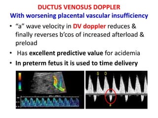 DUCTUS VENOSUS DOPPLER
With worsening placental vascular insufficiency
• “a” wave velocity in DV doppler reduces &
finally reverses b’cos of increased afterload &
preload
• Has excellent predictive value for acidemia
• In preterm fetus it is used to time delivery
 