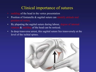 Clinical importance of sutures
• molding of the head in the vertex presentation
• Position of fontanelle & sagittal suture can identify attitude and
position of vertex.
• By plapating the sagittal suture during labour, degree of internal
rotation & molding of the head can be noticed.
• In deep transverse arrest, this sagittal suture lies transversely at the
level of the ischial spines.
 