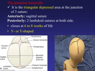 The posterior fontanelle:
 It is the triangular depressed area at the junction
of 3 suture:
Anteriorly: sagittal suture
Posteriorly: 2 lambdoid sutures at both side.
• closes at 6 to 8 weeks of life
• Y- or T-shaped
 