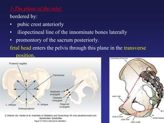 1-The plane of the inlet:
bordered by:
• pubic crest anteriorly
• iliopectineal line of the innominate bones laterally
• promontory of the sacrum posteriorly.
fetal head enters the pelvis through this plane in the transverse
position.
 
