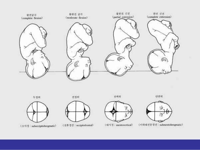 Fetal presentation Fetal presentation