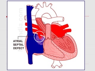 Fetal heart circulation