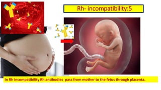 Incompability Rhesus Fetal hemoglobin and rh incompatibility | PDF
