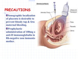 PRECAUTIONS
Sonographic localization
of placenta is desirable to
prevent bloody tap & feta
maternal bleeding.
Prophylactic
administration of 100mg of
anti-D immunoglobulin in
Rh-negative non immunized
mother.
 