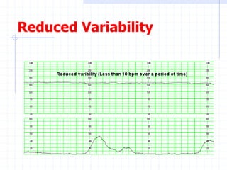 Reduced Variability
 