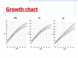 Growth chart
 