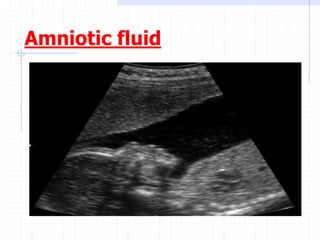 Amniotic fluid
 