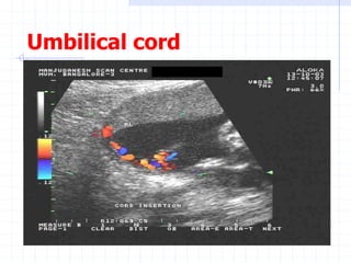 Umbilical cord
 