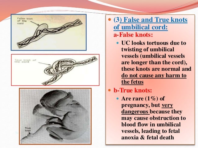 Fetal membranes