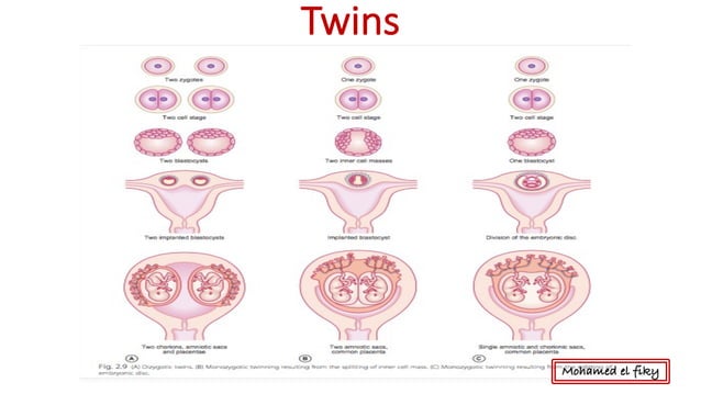 Fetal membranes , placenta and twins | PDF | Pregnancy | Reproductive ...