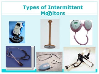 Types of Intermittent
Monitors
 