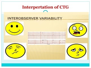 Interpertation of CTG
 