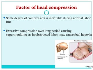 Factor of head compression
Some degree of compression is inevitable during normal labor
But
Excessive compression over l...