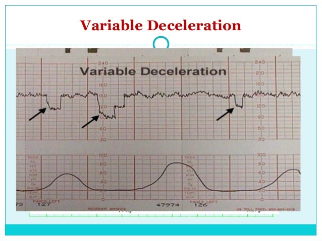 Fetal monitoring for undergraduate