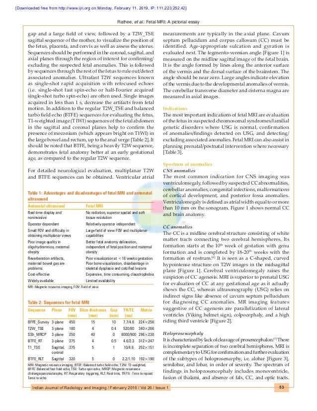 How mri works physics picture