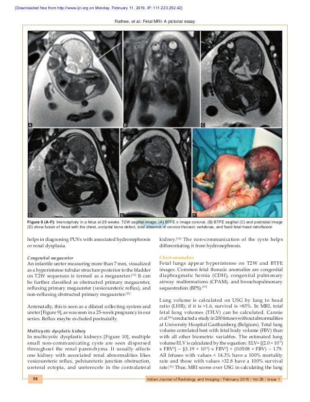 Fetal face mri picture