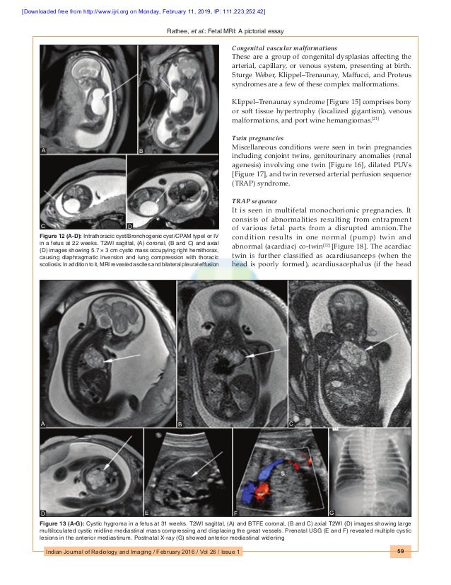 How to read fetal mri picture