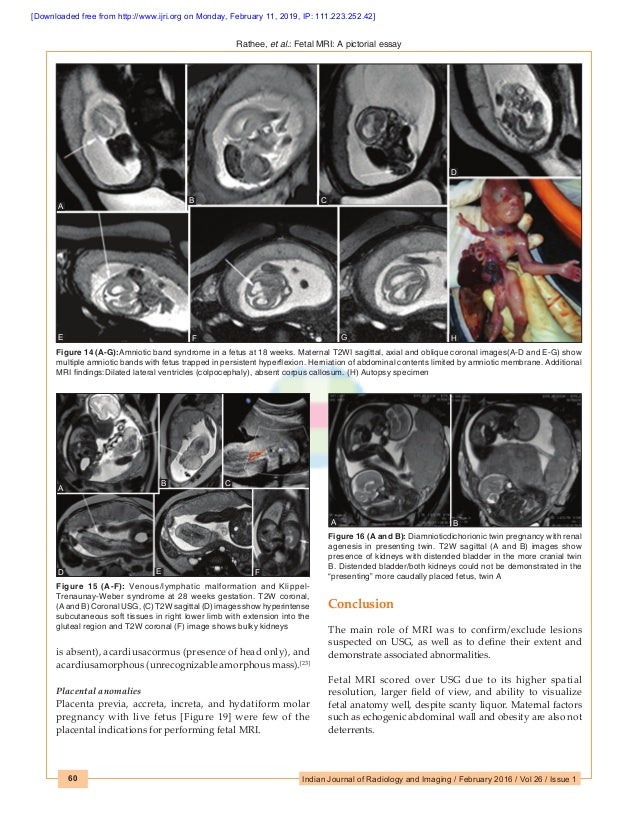 Fetal mri radiographics image
