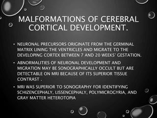 MALFORMATIONS OF CEREBRAL
CORTICAL DEVELOPMENT.
• NEURONAL PRECURSORS ORIGINATE FROM THE GERMINAL
MATRIX LINING THE VENTRICLES AND MIGRATE TO THE
DEVELOPING CORTEX BETWEEN 7 AND 20 WEEKS’ GESTATION.
• ABNORMALITIES OF NEURONAL DEVELOPMENT AND
MIGRATION MAY BE SONOGRAPHICALLY OCCULT BUT ARE
DETECTABLE ON MRI BECAUSE OF ITS SUPERIOR TISSUE
CONTRAST .
• MRI WAS SUPERIOR TO SONOGRAPHY FOR IDENTIFYING
SCHIZENCEPHALY, LISSENCEPHALY, POLYMICROGYRIA, AND
GRAY MATTER HETEROTOPIA
 